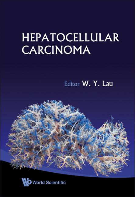 HEPATOCELLULAR CARCINOMA