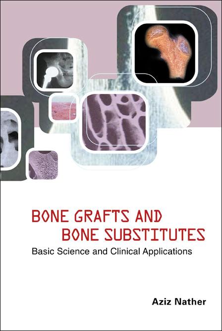 BONE GRAFTS & BONE SUBSTITUTES