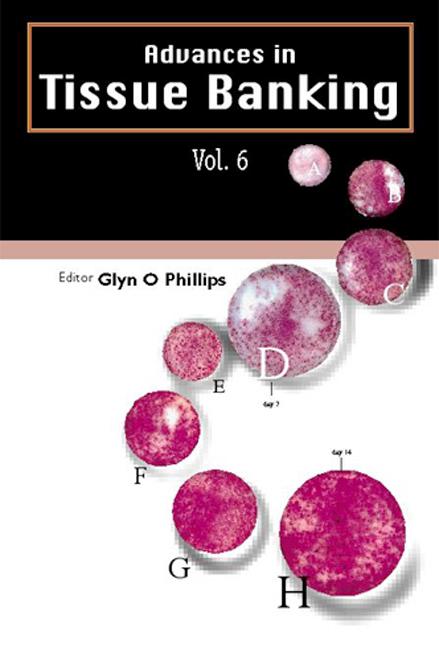 ADVANCES IN TISSUE BANKING (V6) by Phillips Glyn O