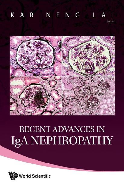 RECENT ADVANCES IN IGA NEPHROPATHY