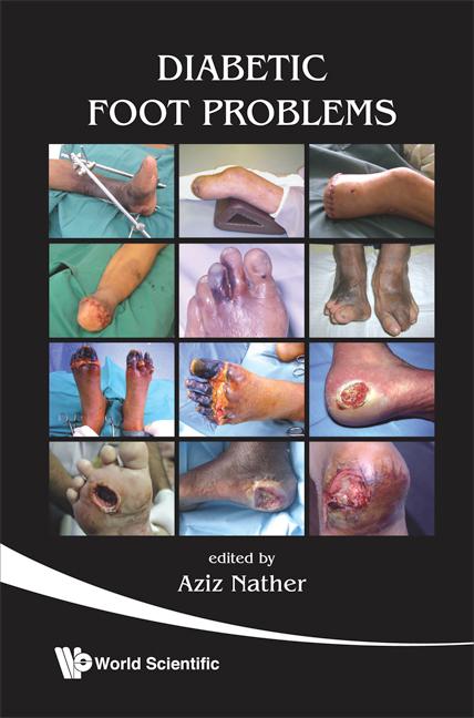 DIABETIC FOOT PROBLEMS