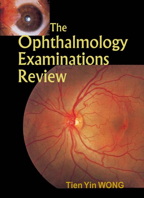 OPHTHALMOLOGY EXAM REVIEW, THE