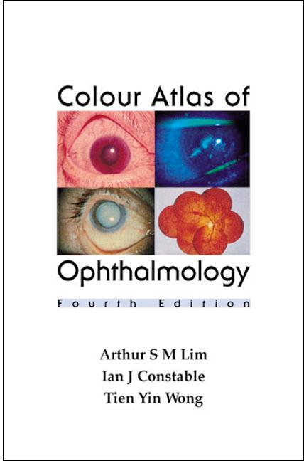 COLOUR ATLAS OPHTHALM (4TH ED)