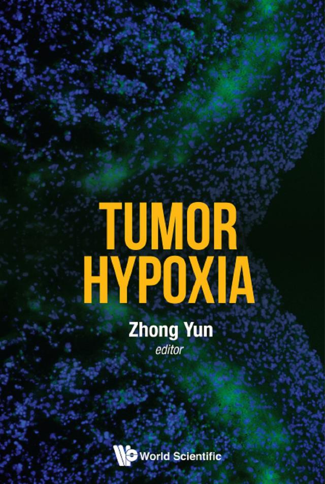TUMOR HYPOXIA by Yun Zhong