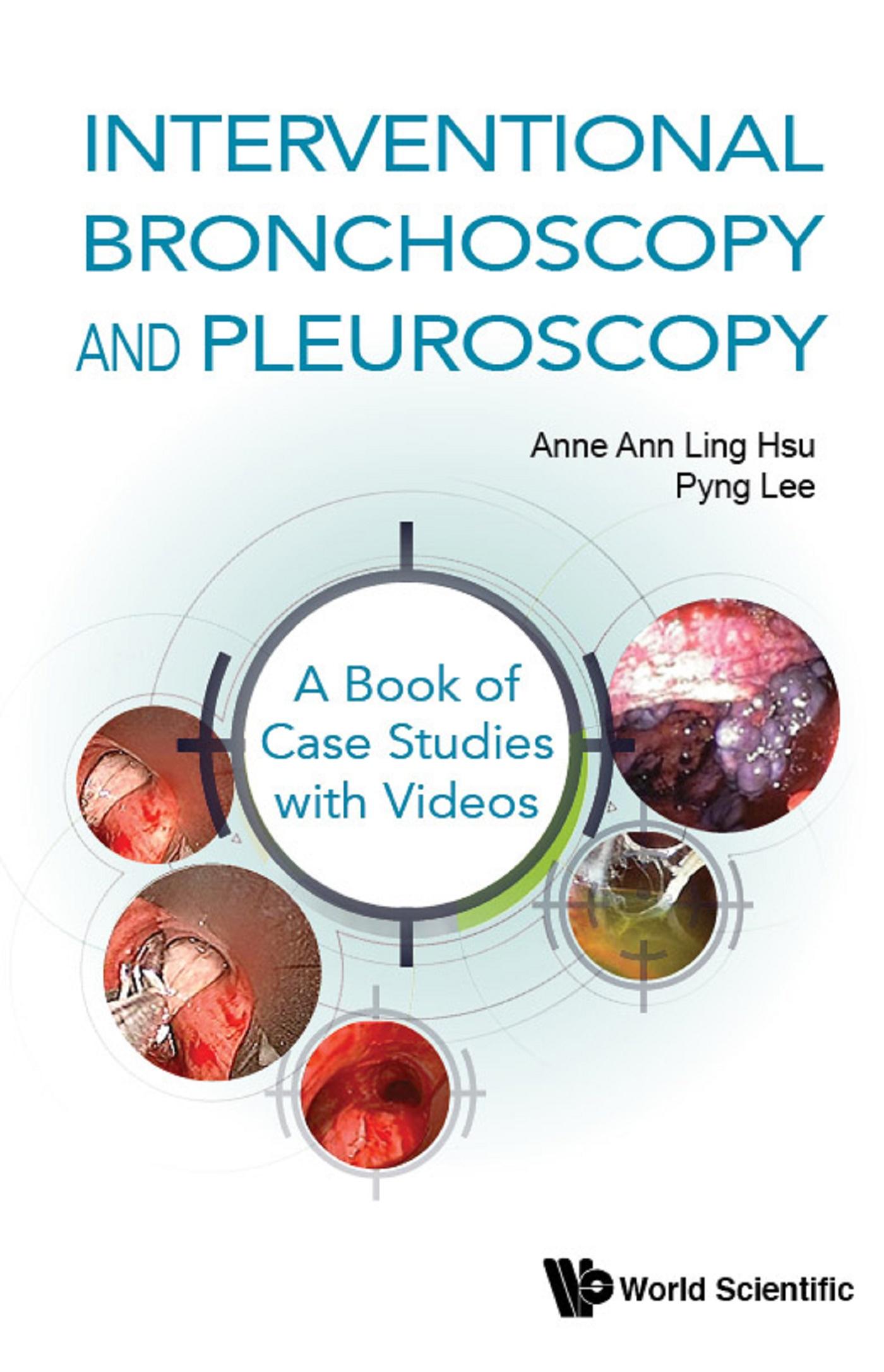 INTERVENT BRONCHOSCOPY & PLEUROSCOPY: BK CASE STUD + VIDEO