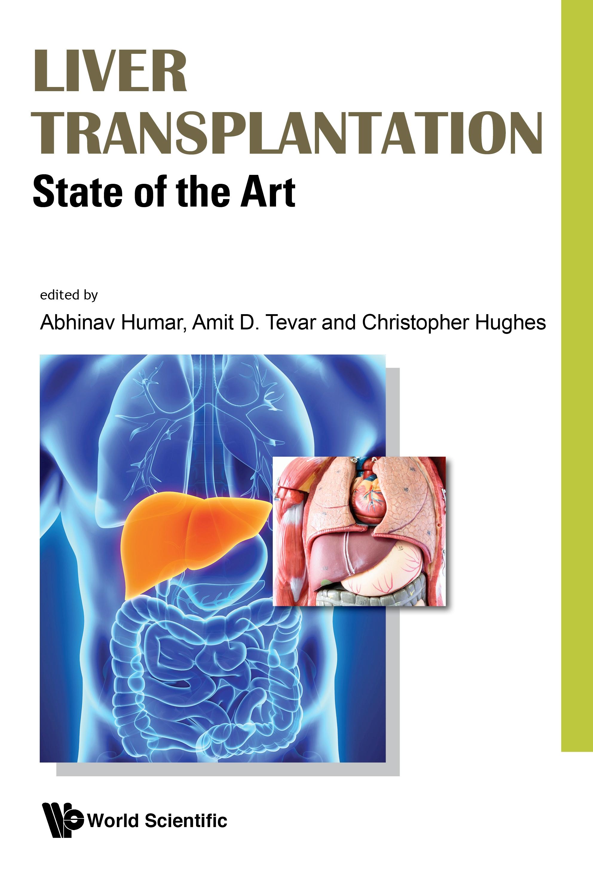 LIVER TRANSPLANTATION: STATE OF THE ART