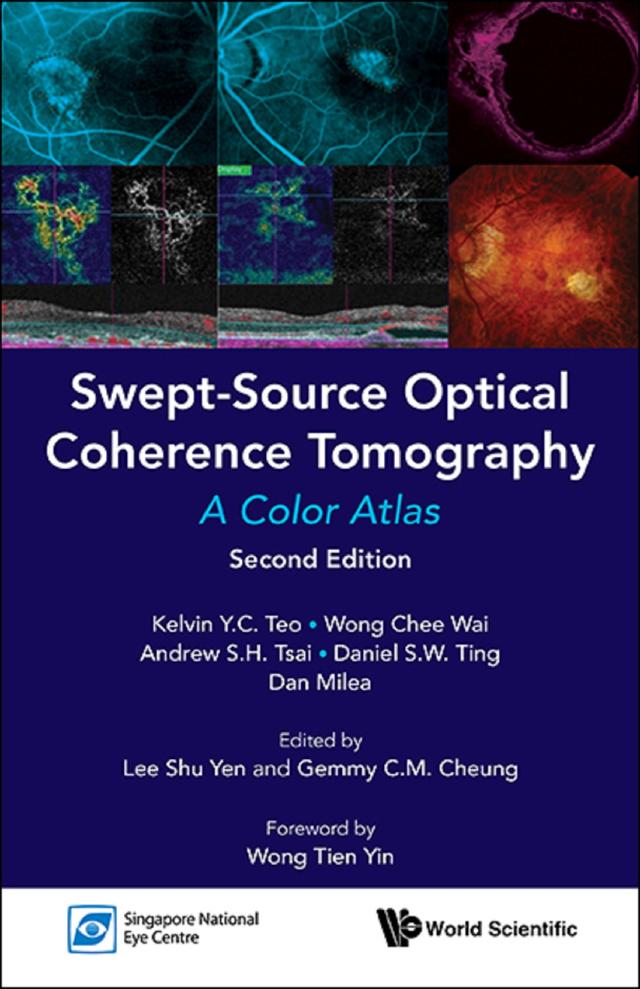 SWEPT-SOURCE OPTIC COHE (2ND ED) by Andrew Shih Hsiang Tsai, Chee Wai Wong, Daniel Shu Wei Ting, Dan Milea, Gemmy Chui Ming Cheung, Kelvin Yi Chong Teo, Shu Yen Lee, Tien Yin Wong