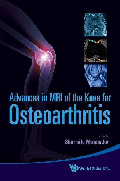 ADV IN MRI OF THE KNEE FOR OSTEOARTHRITI