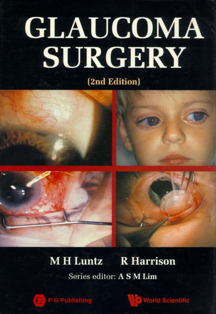GLAUCOMA SURGERY (2ND EDITION)