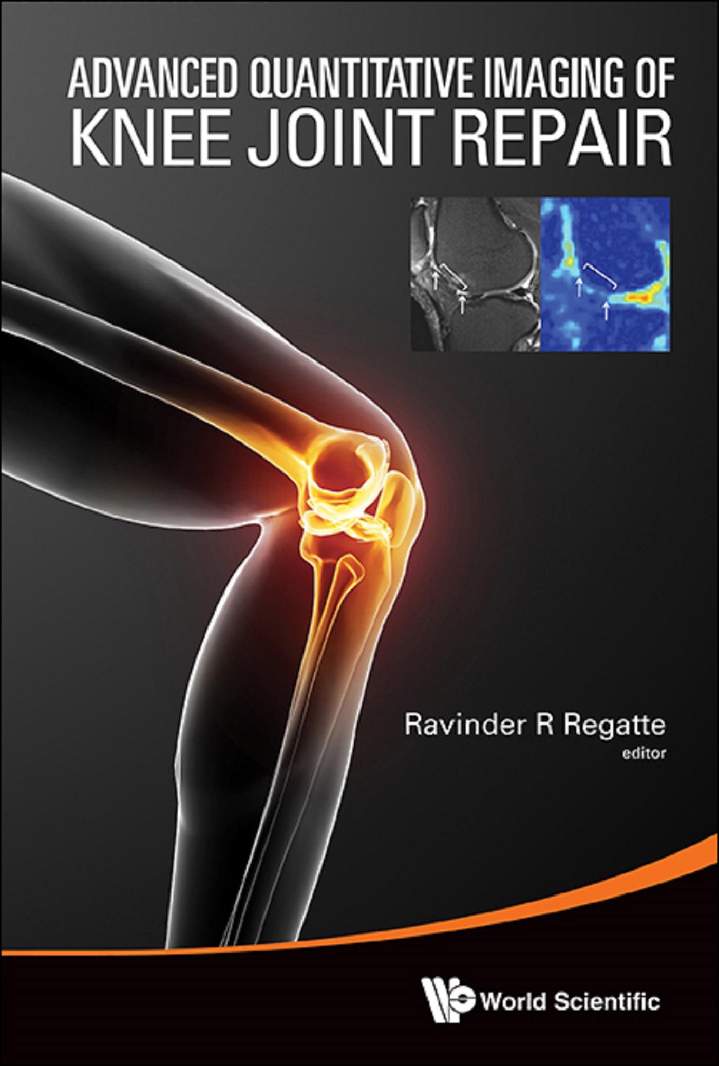 ADVANCED QUANTITATIVE IMAGING OF KNEE JOINT REPAIR