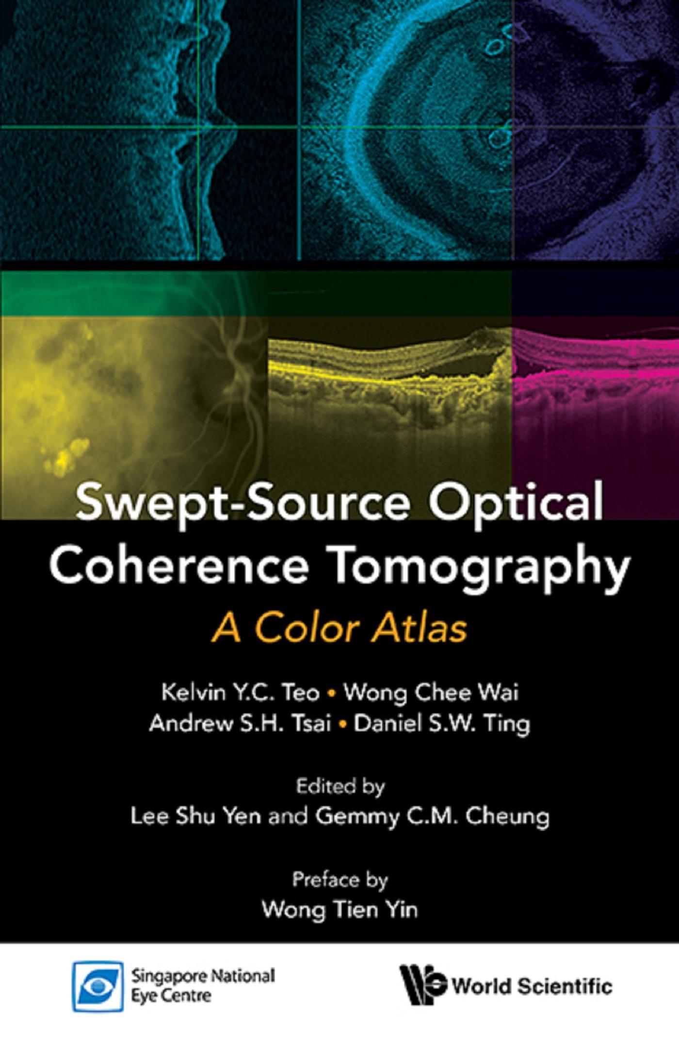 SWEPT-SOURCE OPTICAL COHERENCE TOMOGRAPHY: A COLOR ATLAS