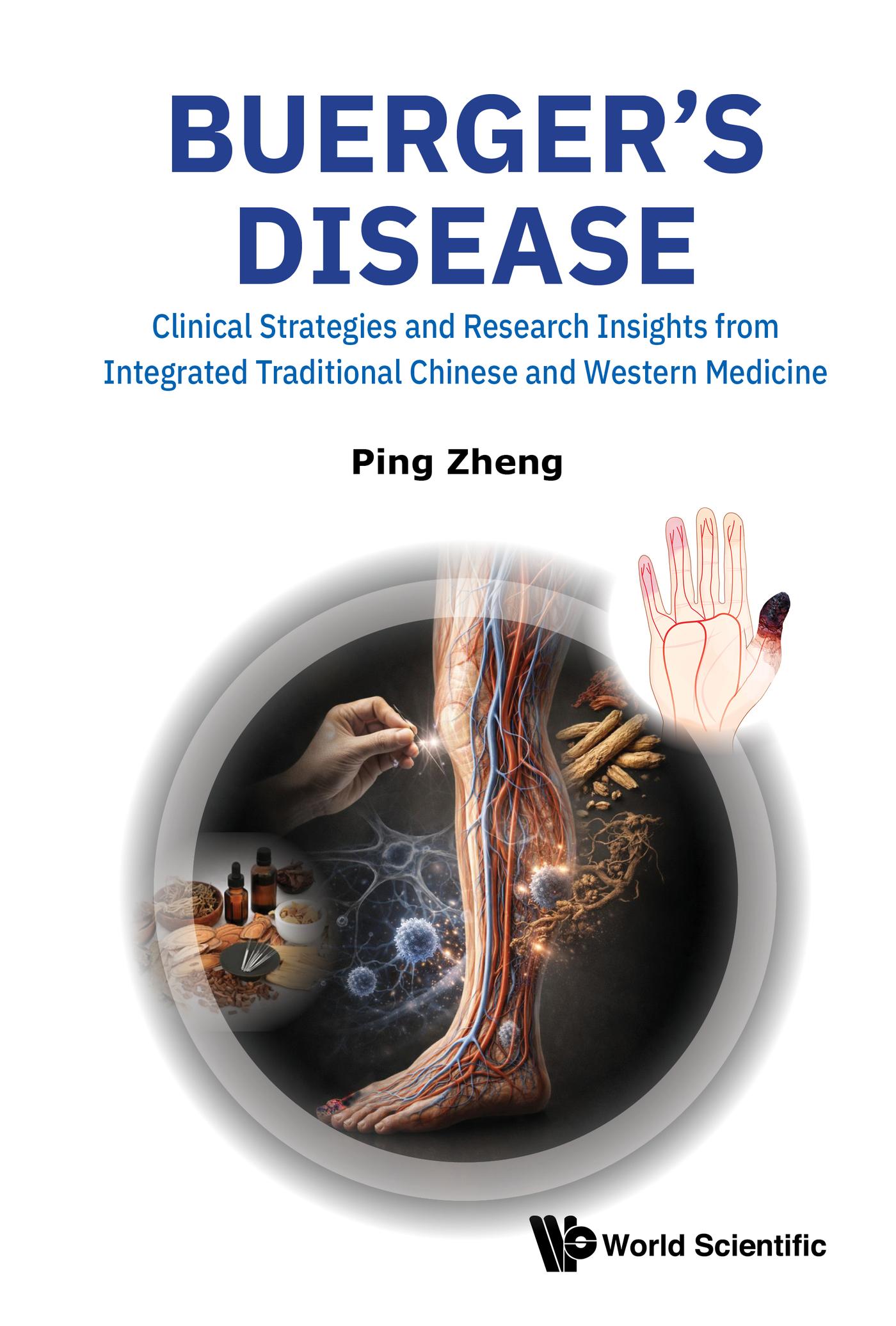 BUERGER'S DISEASE