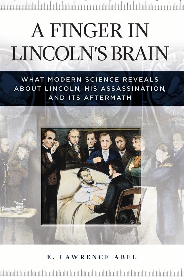 A Finger in Lincoln's Brain by E. Lawrence Abel